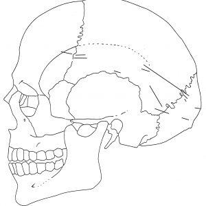 Ambushed! Victim’s Bones at Fort Laurens - Journal of the American ...